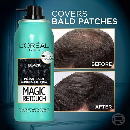 L'Oreal Paris Magic Retouch Instant Root Concealer Spray - Black, Volume-75 ml, For All Hair Types, Instant Grey Coverage, Water-proof, Transfer-proof & Quick-drying Formula